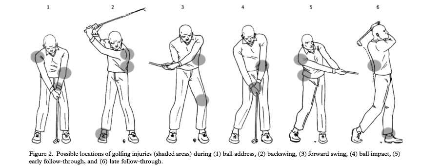 A diagram of the golf swing in motion. This article explores the most common injuries in golfers and how to prevent them