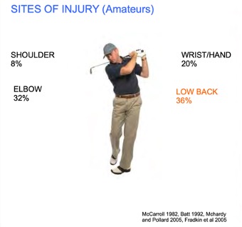 A diagram showing the sites of the most common golf related injuries