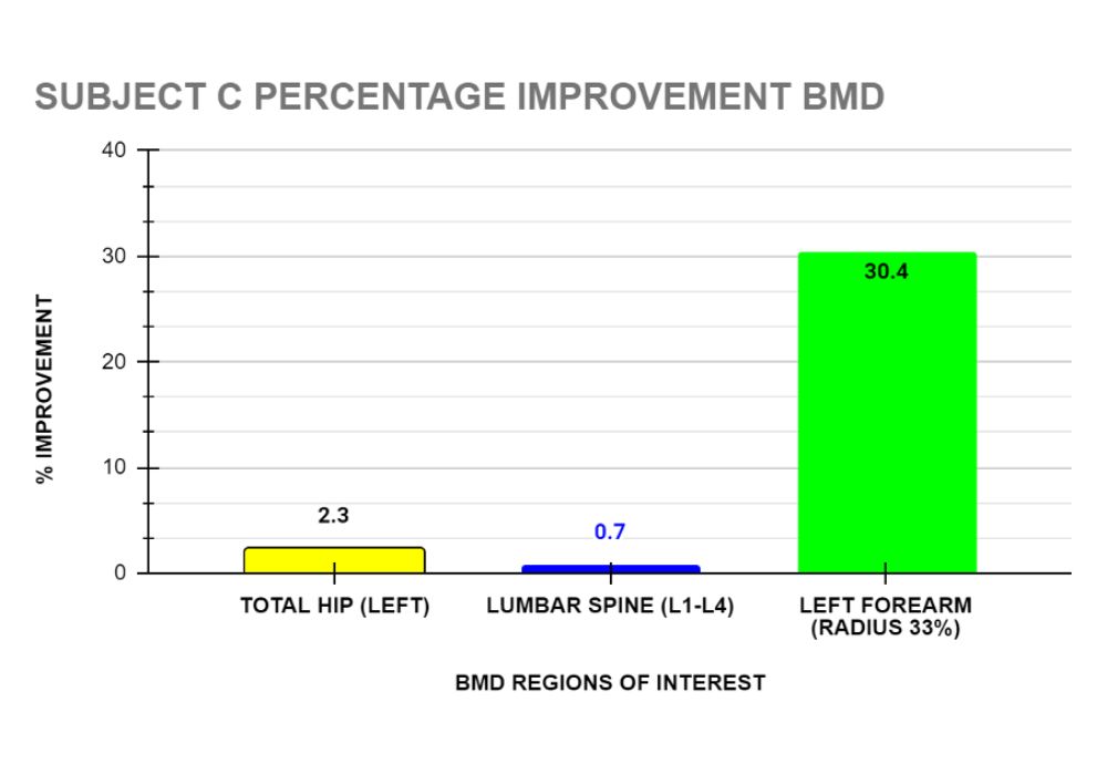 ONERO Case Study Hong Kong 2023 - Graph 11 Percentage Improvement of Bone Mineral Density Subject C