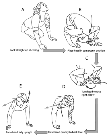 Instructions for the Foster Manoeuvre, used to treat BPPV by physiotherapists 